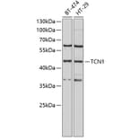 Western Blot - Anti-TCN1 Antibody (A9856) - Antibodies.com