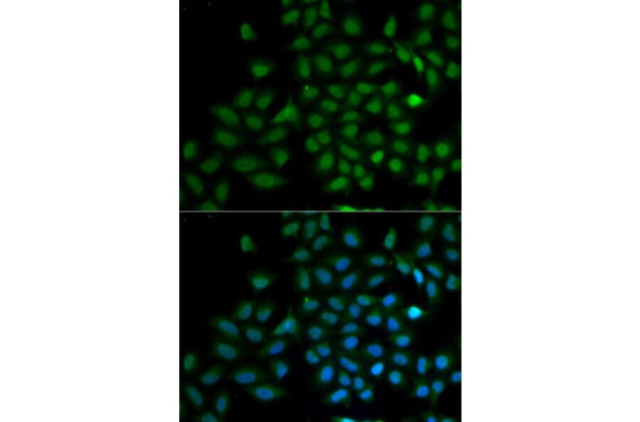 Immunofluorescence - Anti-KLF10 Antibody (A6415) - Antibodies.com