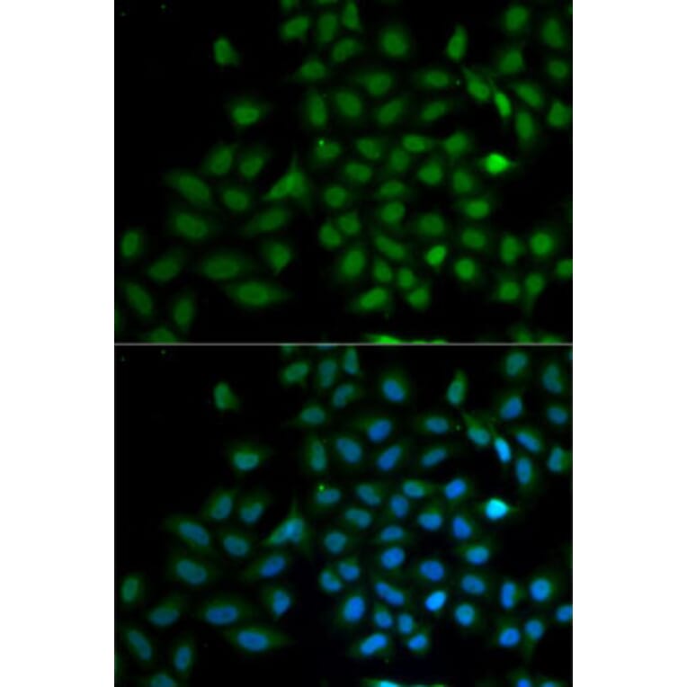 Immunofluorescence - Anti-KLF10 Antibody (A6415) - Antibodies.com