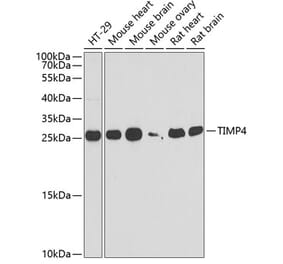 Western Blot - Anti-TIMP4 Antibody (A9858) - Antibodies.com