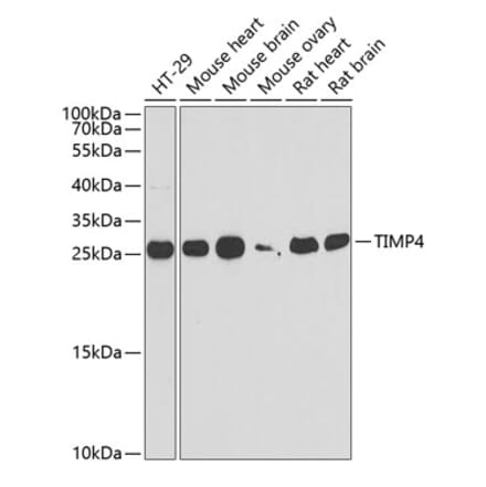 Western Blot - Anti-TIMP4 Antibody (A9858) - Antibodies.com
