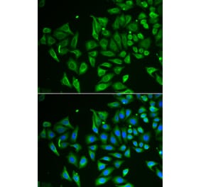 Immunofluorescence - Anti-Tetranectin Antibody (A9859) - Antibodies.com