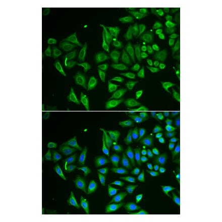 Immunofluorescence - Anti-Tetranectin Antibody (A9859) - Antibodies.com