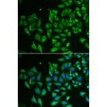 Immunofluorescence - Anti-Tetranectin Antibody (A9859) - Antibodies.com