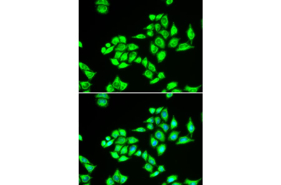 Immunofluorescence - Anti-TPD52L1 Antibody (A6420) - Antibodies.com
