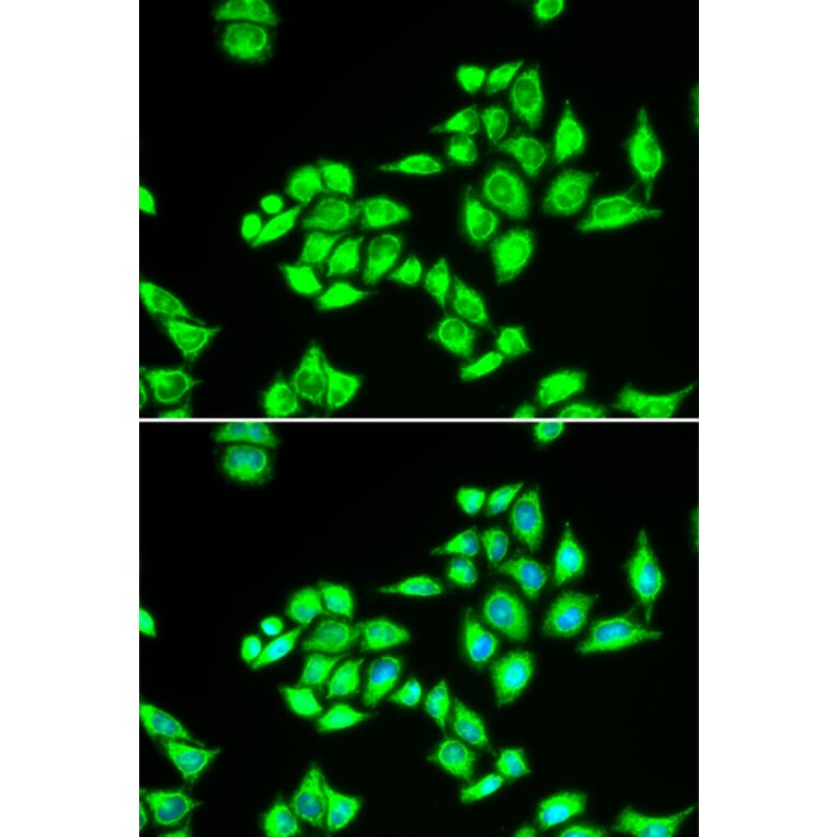 Immunofluorescence - Anti-TPD52L1 Antibody (A6420) - Antibodies.com