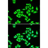 Immunofluorescence - Anti-TPD52L1 Antibody (A6420) - Antibodies.com