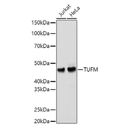 Western Blot - Anti-TUFM Antibody (A9861) - Antibodies.com