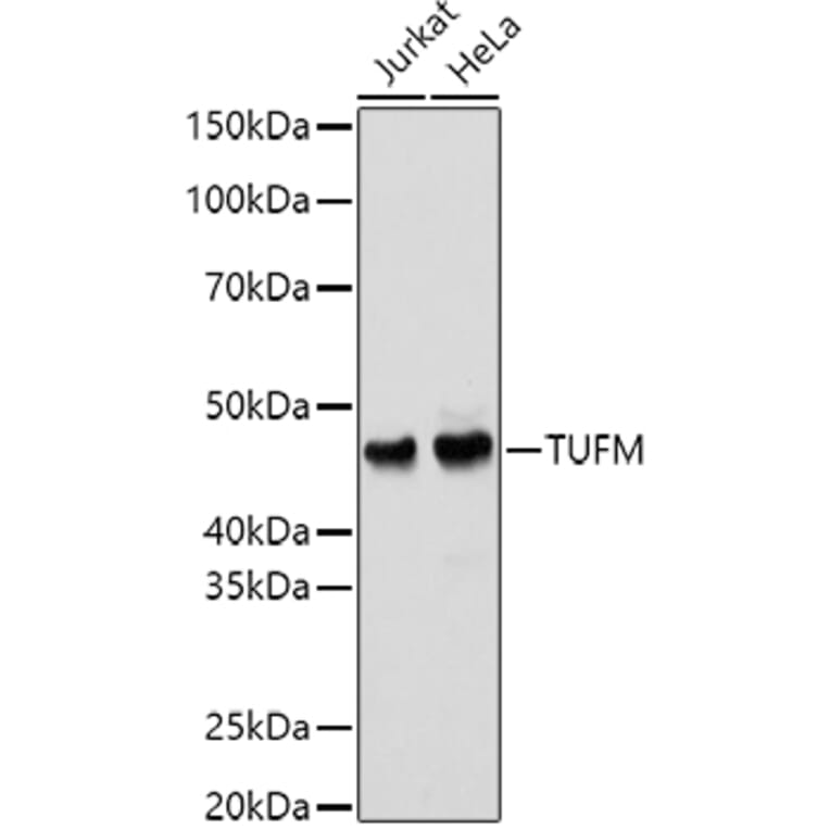 Western Blot - Anti-TUFM Antibody (A9861) - Antibodies.com