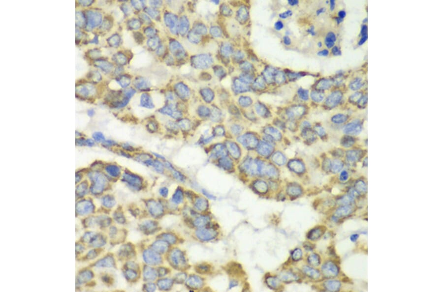 Immunohistochemistry - Anti-TUFM Antibody (A9861) - Antibodies.com