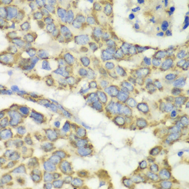 Immunohistochemistry - Anti-TUFM Antibody (A9861) - Antibodies.com