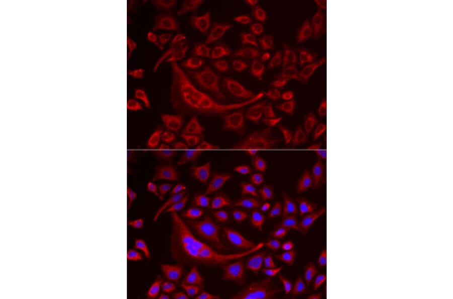 Immunofluorescence - Anti-TUFM Antibody (A9861) - Antibodies.com