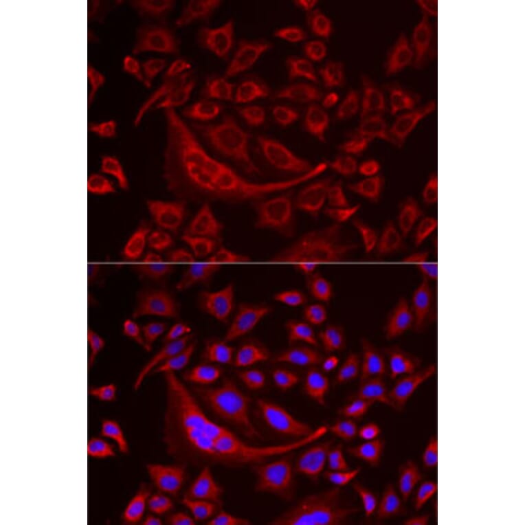 Immunofluorescence - Anti-TUFM Antibody (A9861) - Antibodies.com