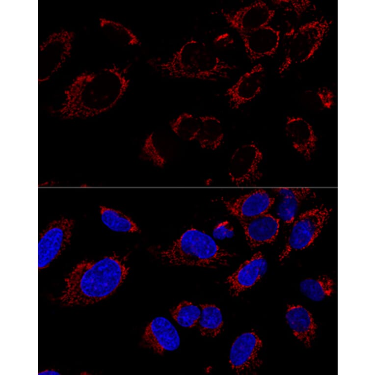 Immunofluorescence - Anti-TUFM Antibody (A9861) - Antibodies.com