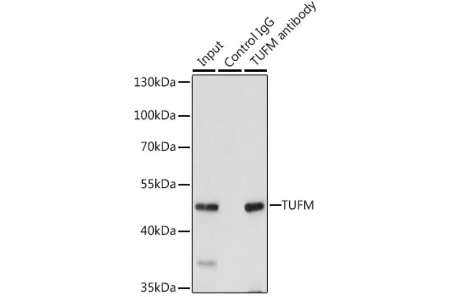 Western Blot - Anti-TUFM Antibody (A9861) - Antibodies.com