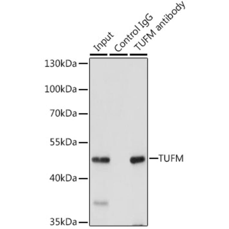 Western Blot - Anti-TUFM Antibody (A9861) - Antibodies.com