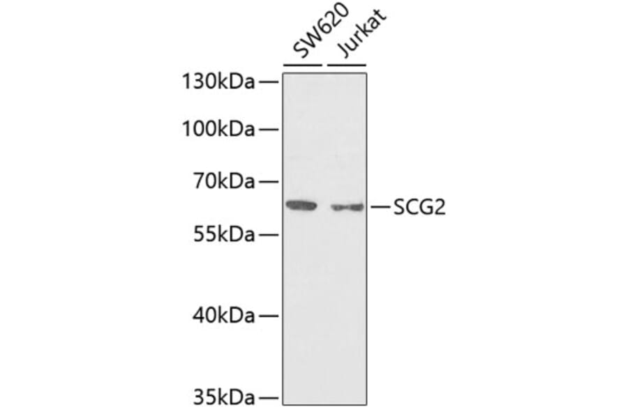 Western Blot - Anti-Chromogranin C/SGII Antibody (A9862) - Antibodies.com