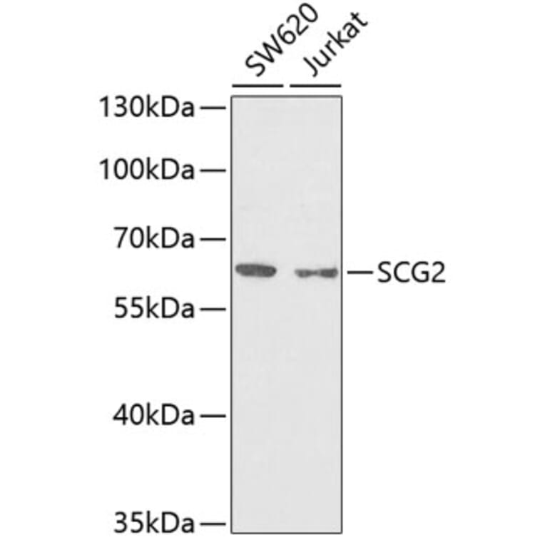 Western Blot - Anti-Chromogranin C/SGII Antibody (A9862) - Antibodies.com