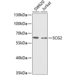 Western Blot - Anti-Chromogranin C/SGII Antibody (A9862) - Antibodies.com