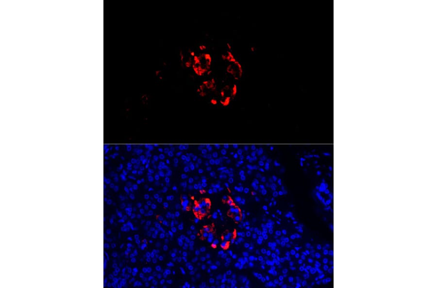 Immunofluorescence - Anti-Chromogranin C/SGII Antibody (A9862) - Antibodies.com