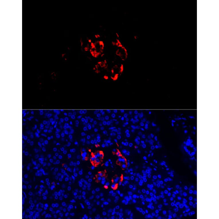 Immunofluorescence - Anti-Chromogranin C/SGII Antibody (A9862) - Antibodies.com
