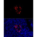 Immunofluorescence - Anti-Chromogranin C/SGII Antibody (A9862) - Antibodies.com