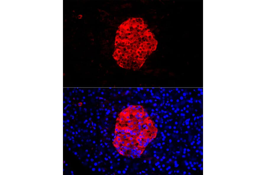Immunofluorescence - Anti-Chromogranin C/SGII Antibody (A9862) - Antibodies.com