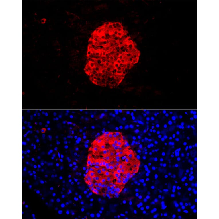 Immunofluorescence - Anti-Chromogranin C/SGII Antibody (A9862) - Antibodies.com