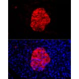 Immunofluorescence - Anti-Chromogranin C/SGII Antibody (A9862) - Antibodies.com