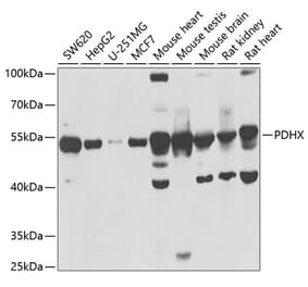 Western Blot - Anti-PDHX Antibody (A9863) - Antibodies.com