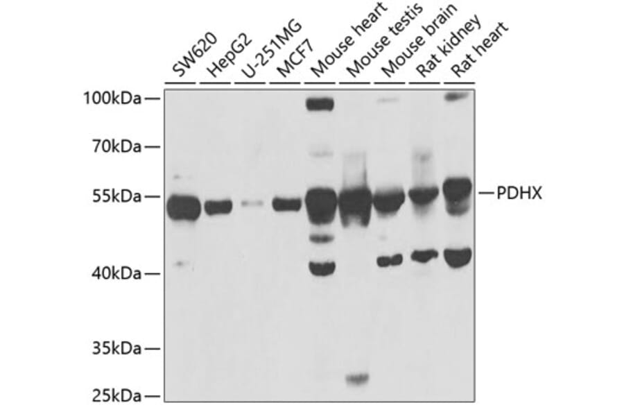 Western Blot - Anti-PDHX Antibody (A9863) - Antibodies.com