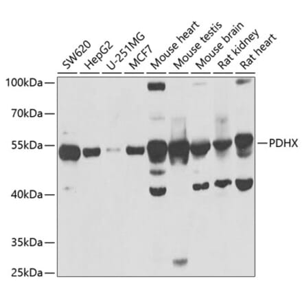 Western Blot - Anti-PDHX Antibody (A9863) - Antibodies.com