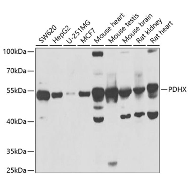 Western Blot - Anti-PDHX Antibody (A9863) - Antibodies.com