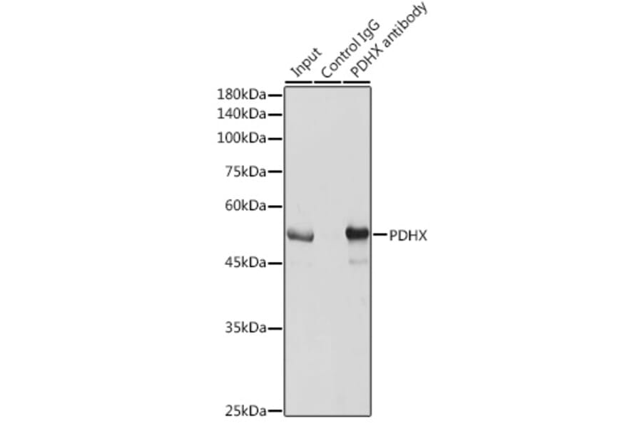 Western Blot - Anti-PDHX Antibody (A9863) - Antibodies.com