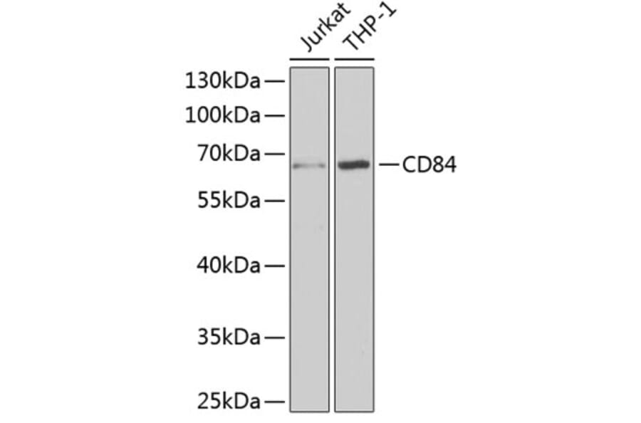 Western Blot - Anti-CD84 Antibody (A9865) - Antibodies.com