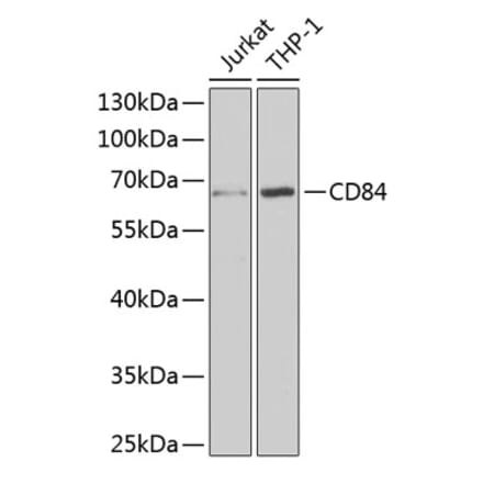 Western Blot - Anti-CD84 Antibody (A9865) - Antibodies.com