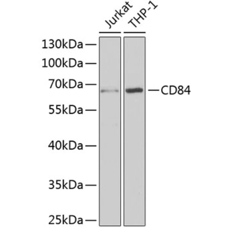 Western Blot - Anti-CD84 Antibody (A9865) - Antibodies.com