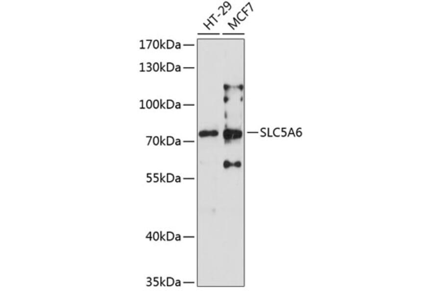 Western Blot - Anti-SLC5A6 Antibody (A6434) - Antibodies.com