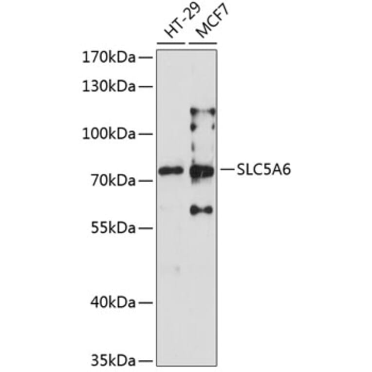 Western Blot - Anti-SLC5A6 Antibody (A6434) - Antibodies.com