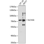 Western Blot - Anti-SLC5A6 Antibody (A6434) - Antibodies.com