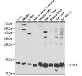 Western Blot - Anti-COX5A Antibody (A9867) - Antibodies.com