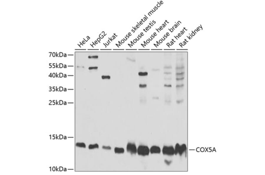 Western Blot - Anti-COX5A Antibody (A9867) - Antibodies.com