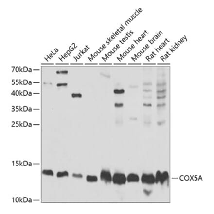 Western Blot - Anti-COX5A Antibody (A9867) - Antibodies.com