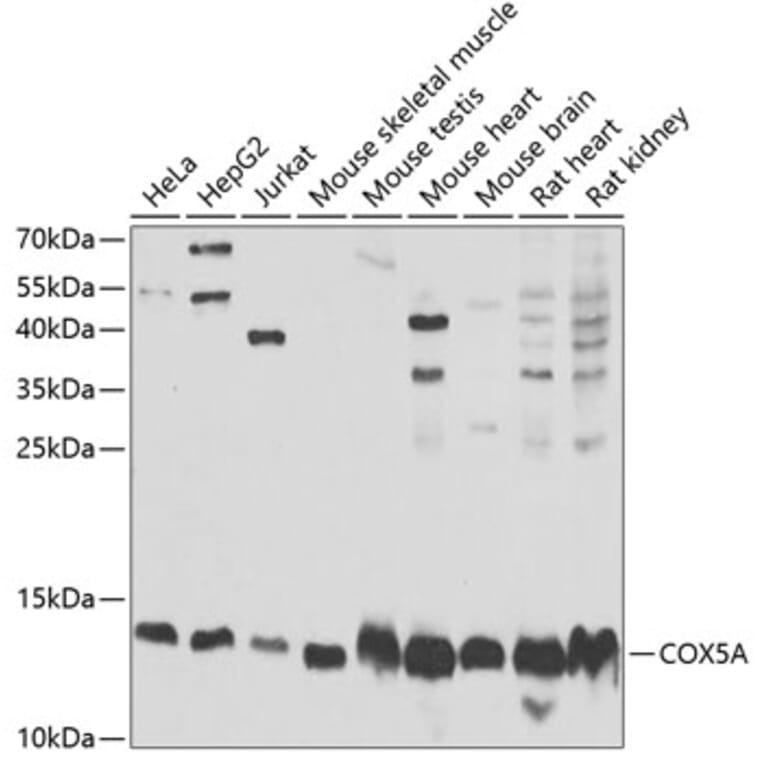 Western Blot - Anti-COX5A Antibody (A9867) - Antibodies.com