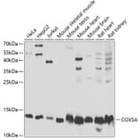 Western Blot - Anti-COX5A Antibody (A9867) - Antibodies.com