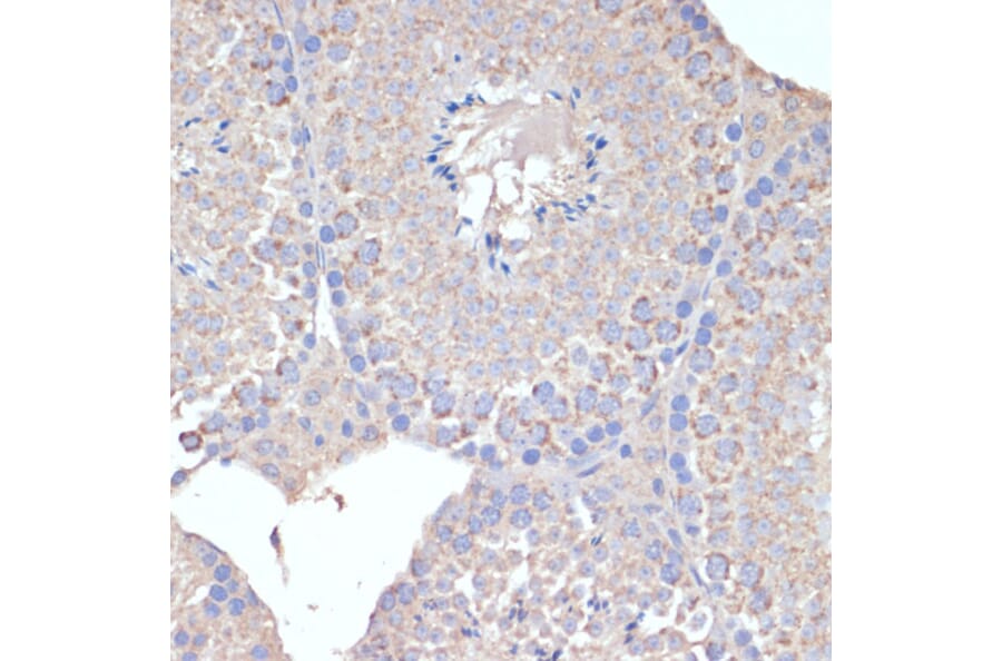 Immunohistochemistry - Anti-COX5A Antibody (A9867) - Antibodies.com