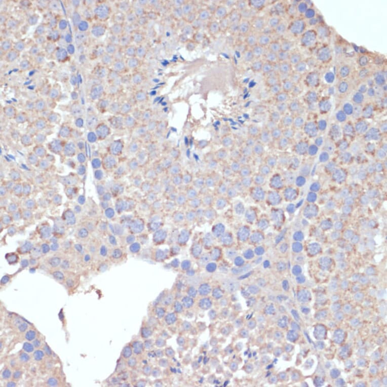 Immunohistochemistry - Anti-COX5A Antibody (A9867) - Antibodies.com