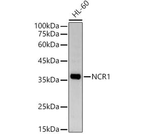 Western Blot - Anti-NCR1 Antibody (A9868) - Antibodies.com
