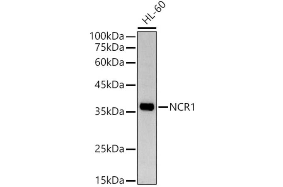 Western Blot - Anti-NCR1 Antibody (A9868) - Antibodies.com