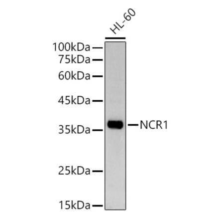 Western Blot - Anti-NCR1 Antibody (A9868) - Antibodies.com